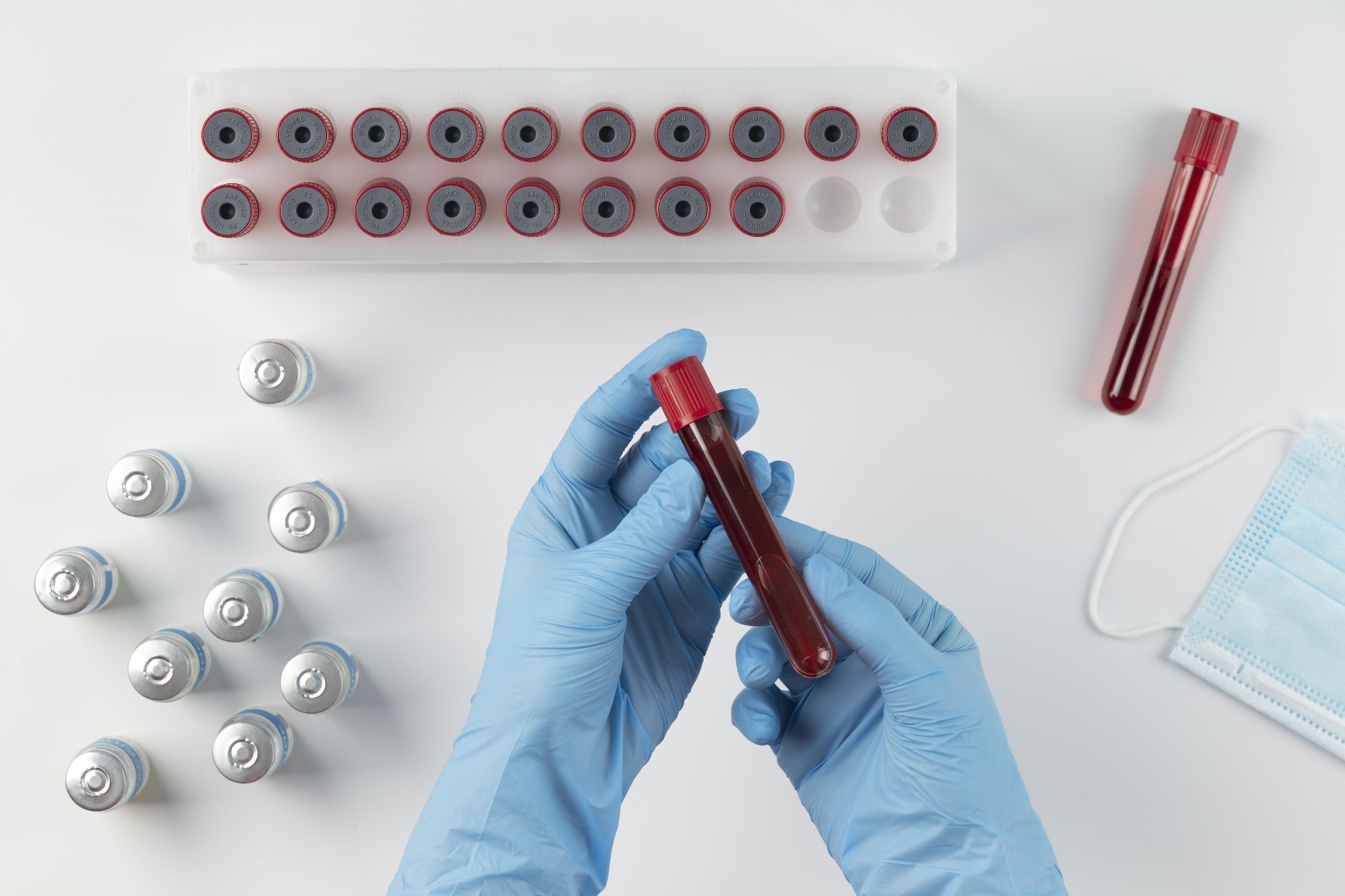 Hematoloji Testleri